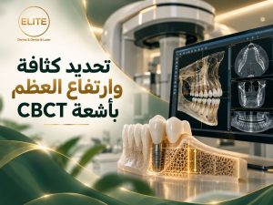 تحديد كثافة وارتفاع العظم بأشعة CBCT