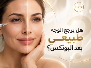هل يرجع الوجه طبيعي بعد البوتكس