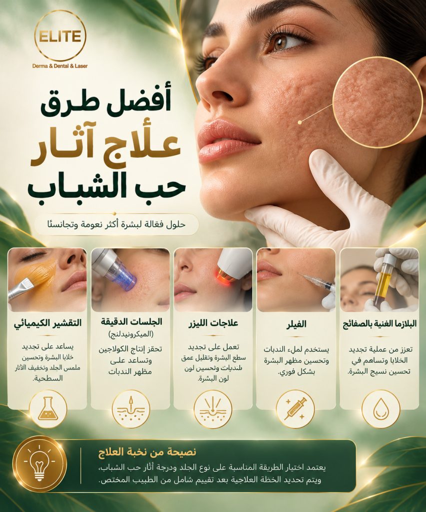 أفضل طرق علاج آثار حب الشباب: دليلك الشامل للحصول على بشرة خالية من الندوب والبقع