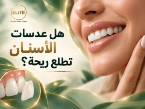 هل عدسات الأسنان تطلع ريحة فعلًا؟ الحقيقة التي يجب معرفتها